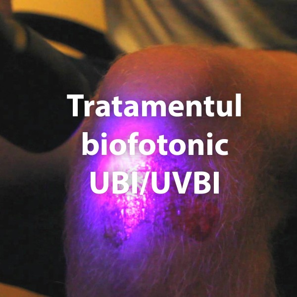 Tratamentul biofotonic UBI/UVBI – ULTRAVIOLET BLOOD IRADIATION