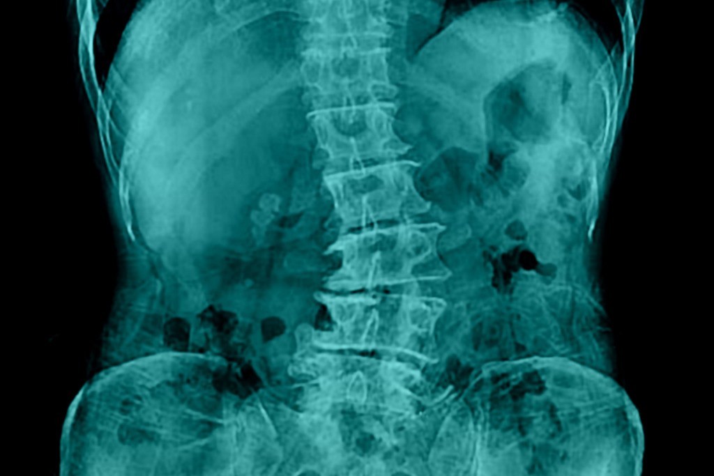 tratament medicamentos al articulațiilor și coloanei vertebrale