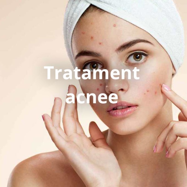 Tratament acnee