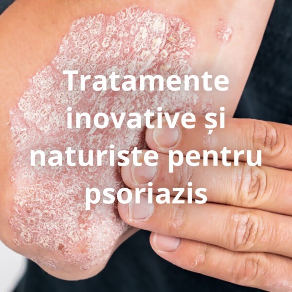 Tratamente inovative si naturiste pentru psoriazis