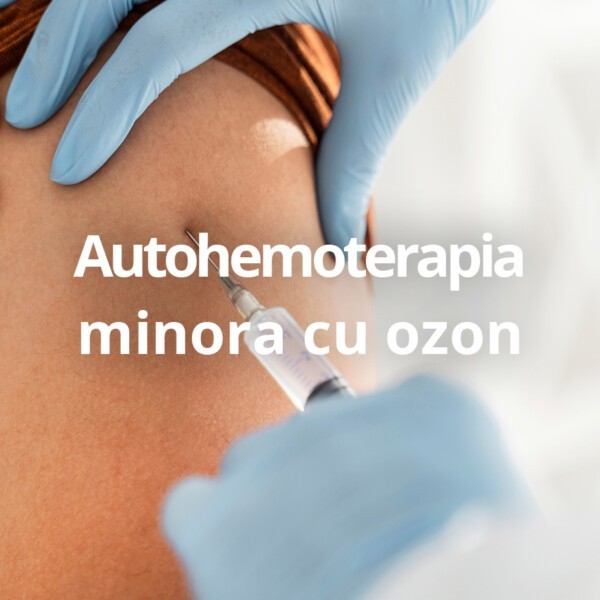 Autohemoterapia minora cu ozon